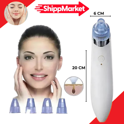 REMOVEDOR DE PUNTOS NEGROS