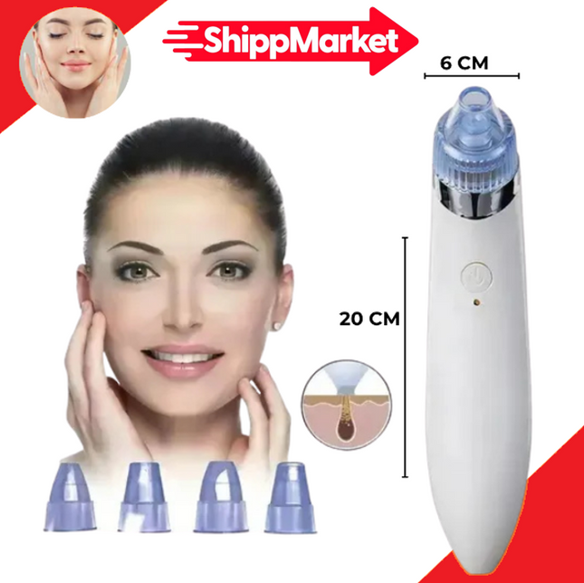 REMOVEDOR DE PUNTOS NEGROS